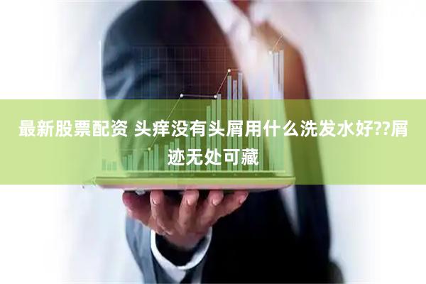 最新股票配资 头痒没有头屑用什么洗发水好??屑迹无处可藏